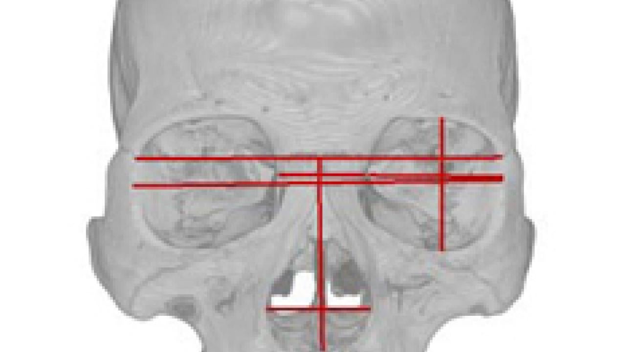 Images of skulls show appproximate locations of the lateral, anterior and inferior cranial measurements used in the analyses.
