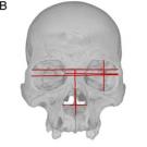 Images of skulls show appproximate locations of the lateral, anterior and inferior cranial measurements used in the analyses.
